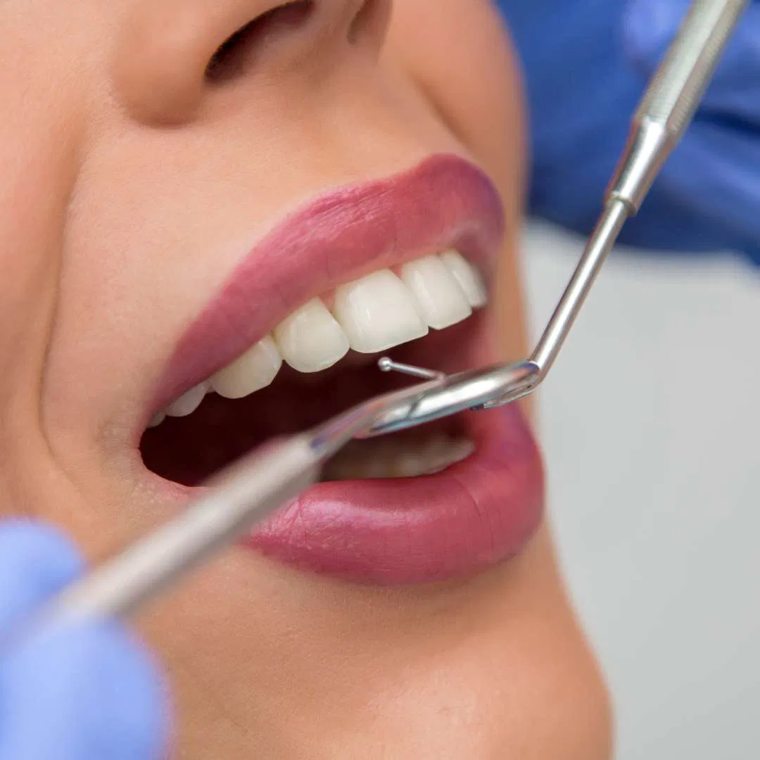 Rengöring med GBT Metod